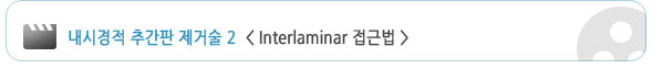 ð ߰ ż 2 <Interlaminar ٹ>
